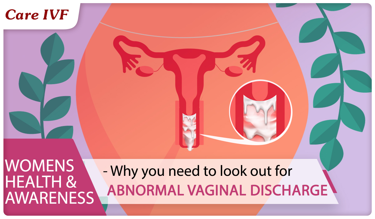 Vaginal Discharge: Causes, Color, Odor & Treatment