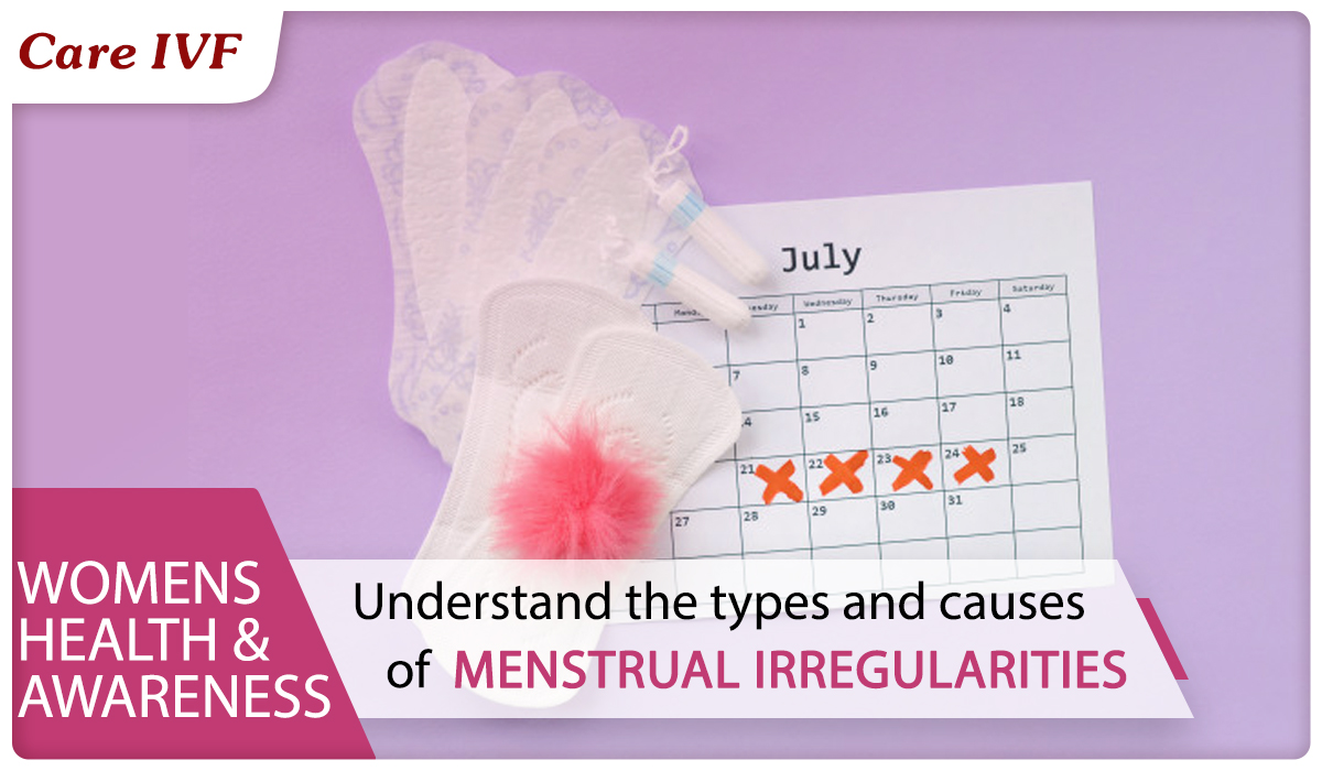 Irregular Menstruation Symptoms Types Causes And Prevention